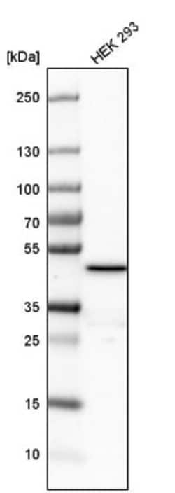FDFT1 Antibody, Novus Biologicals 0.1mL; Unlabeled:Antibodies, Polyclonal