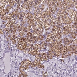 FDX1 Antibody, Novus Biologicals 0.1mL; Unlabeled:Antibodies, Polyclonal