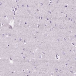 FDX1 Antibody, Novus Biologicals 0.1mL; Unlabeled:Antibodies, Polyclonal