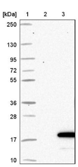FDX1 Antibody, Novus Biologicals 0.1mL; Unlabeled:Antibodies, Polyclonal