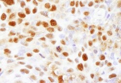 FEN-1 Antibody, Novus Biologicals 100 &mu;L | Buy Online | Novus Biologicals | Fisher Scientific