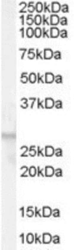 FFAR1/GPR40 Antibody, Novus Biologicals 0.1mg; Unlabeled:Antibodies, Polyclonal