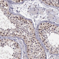 FGD1 Antibody, Novus Biologicals:Antibodies:Primary Antibodies
