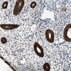FGD6 Antibody, Novus Biologicals:Antibodies:Primary Antibodies