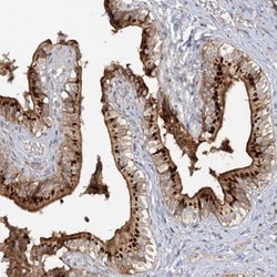 MAGEC1 Antibody, Novus Biologicals:Antibodies:Primary Antibodies