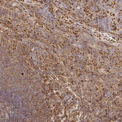 FGF-21 Antibody, Novus Biologicals 25 &mu;L | Buy Online | Novus Biologicals | Fisher Scientific