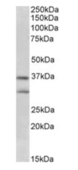 FGF-23 Antibody, Novus Biologicals 0.1mg; Unlabeled:Antibodies, Polyclonal