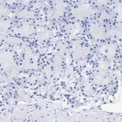FGF-BP Antibody, Novus Biologicals 25 &mu;L; Unlabeled:Antibodies, Polyclonal