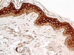 FGFR1 Antibody (M17D10) - BSA Free, Novus Biologicals 0.025mL; Unlabeled:Antibodies,
