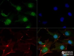 FGFR1 Antibody (M2F12) - BSA Free, Novus Biologicals 0.025 mL | Buy Online | Novus Biologicals | Fisher Scientific