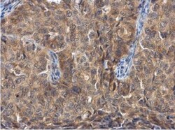 FGFR1OP Antibody, Novus Biologicals 0.1mL; Unlabeled:Antibodies, Polyclonal