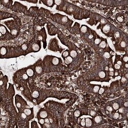 FGFR1OP2 Antibody, Novus Biologicals:Antibodies:Primary Antibodies
