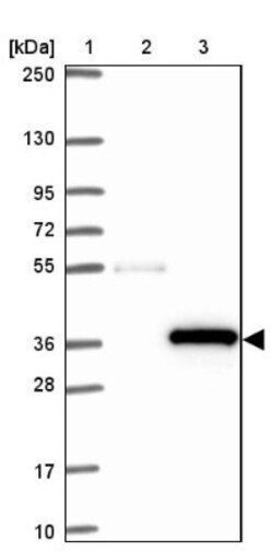 FGFR1OP2 Antibody, Novus Biologicals 25 &mu;L; Unlabeled:Antibodies, Polyclonal