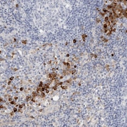 FGL2/Fibroleukin Antibody, Novus Biologicals 25 &mu;L; Unlabeled:Antibodies,