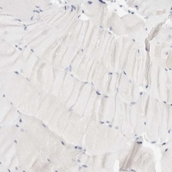 FGL2/Fibroleukin Antibody, Novus Biologicals 25 &mu;L; Unlabeled:Antibodies,