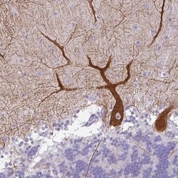 FHAD1 Antibody, Novus Biologicals:Antibodies:Primary Antibodies