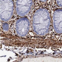 FHL1 Antibody, Novus Biologicals 0.1mL; Unlabeled:Antibodies, Polyclonal