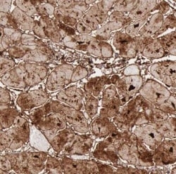 FHL1 Antibody, Novus Biologicals 0.1mL; Unlabeled:Antibodies, Polyclonal