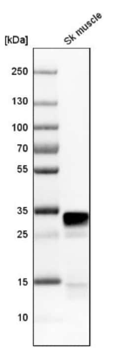 FHL1 Antibody, Novus Biologicals 0.1mL; Unlabeled:Antibodies, Polyclonal