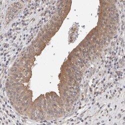 FHOD3 Antibody, Novus Biologicals 0.1mL; Unlabeled:Antibodies, Polyclonal