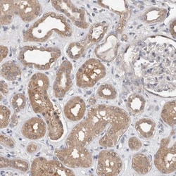 FHOD3 Antibody, Novus Biologicals 0.1mL; Unlabeled:Antibodies, Polyclonal