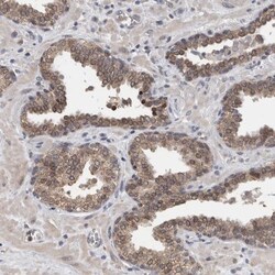 FHOD3 Antibody, Novus Biologicals 0.1mL; Unlabeled:Antibodies, Polyclonal