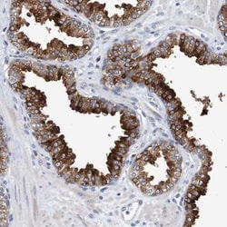 FIBP Antibody, Novus Biologicals 25 &mu;L; Unlabeled:Antibodies, Polyclonal