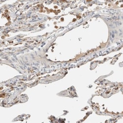 FIP1/RCP Antibody, Novus Biologicals 25 &mu;L; Unlabeled:Antibodies, Polyclonal