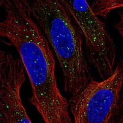 FJX1 Antibody, Novus Biologicals 0.1mL; Unlabeled:Antibodies, Polyclonal