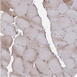 FJX1 Antibody, Novus Biologicals 0.1mL; Unlabeled:Antibodies, Polyclonal
