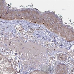 FJX1 Antibody, Novus Biologicals 0.1mL; Unlabeled:Antibodies, Polyclonal
