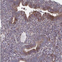 FJX1 Antibody, Novus Biologicals 0.1mL; Unlabeled:Antibodies, Polyclonal