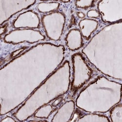 FKBP10 Antibody, Novus Biologicals 0.1mL; Unlabeled:Antibodies, Polyclonal