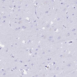 FKBP11 Antibody, Novus Biologicals 25 &mu;L; Unlabeled:Anticorps, Polyclonal