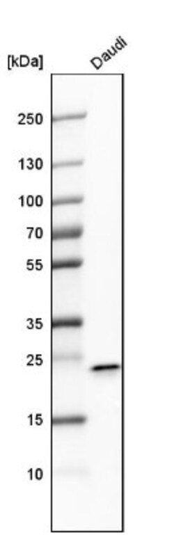 FKBP11 Antibody, Novus Biologicals 25 &mu;L; Unlabeled:Anticorps, Polyclonal