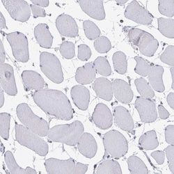 FKBP13/FKBP2 Antibody, Novus Biologicals:Antibodies:Primary Antibodies