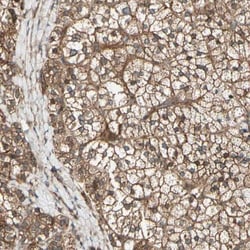 FKBP15 Antibody, Novus Biologicals 0.1mL; Unlabeled:Antibodies, Polyclonal