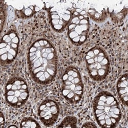 FKBP51/FKBP5 Antibody, Novus Biologicals 0.1mL; Unlabeled:Antibodies, Polyclonal