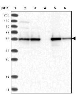 FKBP51/FKBP5 Antibody, Novus Biologicals:Antibodies:Primary Antibodies