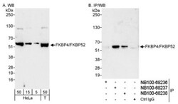 FKBP52/FKBP4 Antibody, Novus Biologicals 0.1mL; Unlabeled:Antibodies, Polyclonal