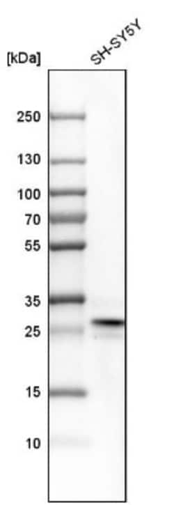 FKBP7 Antibody, Novus Biologicals 25 &mu;L; Unlabeled:Antibodies, Polyclonal