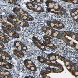 FKTN Antibody, Novus Biologicals 0.1mL; Unlabeled:Antibodies, Polyclonal