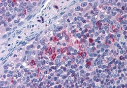 FLAP Antibody, Novus Biologicals 0.1 mg | Buy Online | Novus Biologicals | Fisher Scientific