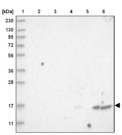 FLAP Antibody, Novus Biologicals 25 &mu;L; Unlabeled:Antibodies, Polyclonal
