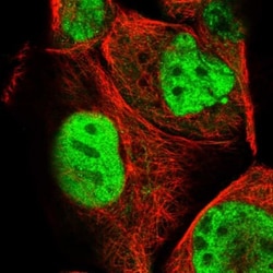 FLJ10154 Antibody, Novus Biologicals:Antibodies:Primary Antibodies