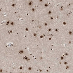 FLJ10154 Antibody, Novus Biologicals:Antibodies:Primary Antibodies
