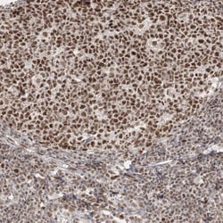 FLJ10154 Antibody, Novus Biologicals:Antibodies:Primary Antibodies