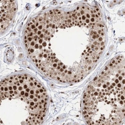 FLJ10154 Antibody, Novus Biologicals:Antibodies:Primary Antibodies