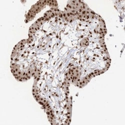 FLJ10154 Antibody, Novus Biologicals:Antibodies:Primary Antibodies