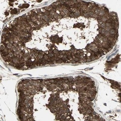 FLJ10769 Antibody, Novus Biologicals 0.1mL; Unlabeled:Antibodies, Polyclonal